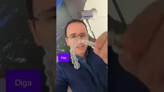 Qual o valor do aparelho Invisalign?