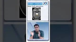 DocTutorials' #QuickLearningByte | Joubert Syndrome - Radiology | Dr Khaleel Ahmed