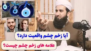 0092- آیا زخم چشم واقعیت دارد علایم زخم چشم در بدن چیست؟
