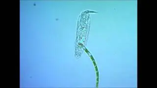 Коловратка Филодина (Philodina roseola)