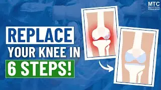 Total Knee Replacement Procedure Abroad (ANIMATED Explanation!)