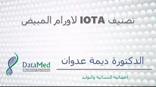 محاضرة الدكتورة ديمة عدوان (تصنيف IOTA الاورام المبيض)