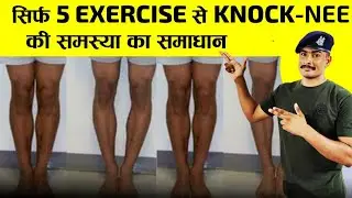 knok knee problem solve only 1 month || सिर्फ़ 1 महीने मैं knok knee problem कर लो ठीक