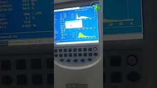 Mindray 1800 CBC analyzer | Hematology Analyzer | CBC test | how to perform CBC|complete blood count