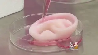 Dr. Max Gomez: 3D Printing Tissue