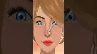 Nose Pimple Removal | #shorts #viralshorts #ytshorts #short #asmr #animation #geeksandgamers
