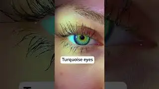 Try Fancy Drops Today! #eyecare #greeneye #eyedrops #greeneyes #eyetreatment #beauty #eyegasm #viral