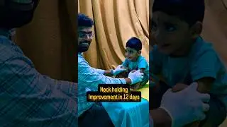 #bhuvikatv #physiotherapy #baby #motivation #cpchild #cpchilddoctor #shortsfeed #shorts