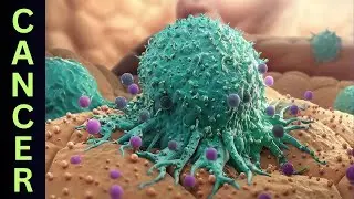 Watch Out! 21 Foods Linked To Cancer That You Should Stay Away From