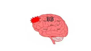 Literature Review - Beta Blockers in Critically Ill Patients with Traumatic Brain Injury