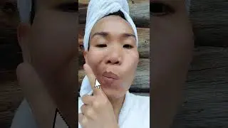 How to reduce jowls/sagging mouth corners with face yoga #faceyoga #saggingskin #faceexercise
