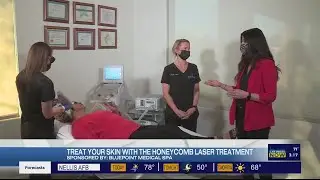 Treat your skin with the honeycomb laser at Blue Point Medical Spa