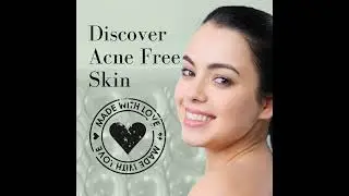 Skinzey's No More Acne  - Anti Acne Cleanser/Facewash
