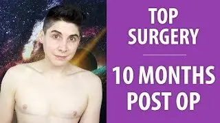 10 Months Post Op (Dr. Garramone) | Nonbinary Top Surgery