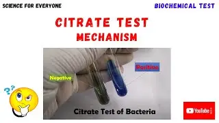 CITRATE TEST | Principle | Procedure | Understanding Results | Chemical Reactions