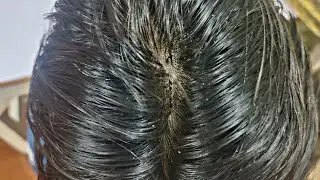 ASMR  high pressure head massage 💆💆💆      #head massage #asmr #relaxing #sound