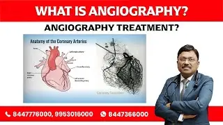 What is Angiography? Angiography Treatment by Dr. Bimal Chhajer