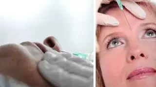 Soft Tissue Fillers vs Botox: What's the Difference?