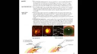 Glaucoma Explained (In Hindi Podcast) #medicalpodcast #glaucoma #ophthalmology #eyehealth