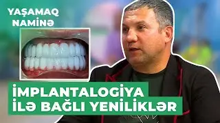 Yaşamaq Naminə | Doktor Sənan Xankişiyevdən implantalogiya ilə bağlı son yeniliklər