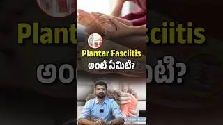 What Is Plantar Fasciitis? Causes, Symptoms & Treatment Explained | NasaHospitals LB Nagar Hyderabad