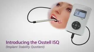 Osstell ISQ прибор для диагностики остеоинтеграции имплантатов