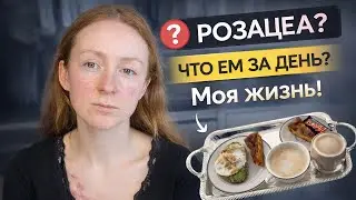 Как я живу с розацеа | Что я ем за день? ДЕНЬ 30