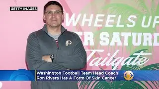 Washington Coach Ron Rivera Has A Form Of Skin Cancer