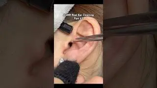 Part 63 | ASMR Ear Cleaning #asmr #earcleaning