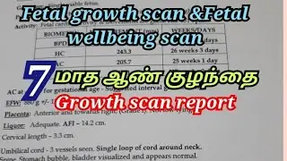 Boy baby growth scan with Doppler 7th month scan report in tamil/what is BPD, HC, AC, FLin pregnancy