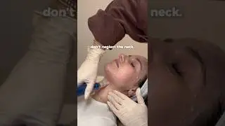 Why Microneedling the Neck & D&eacute;collet&eacute; Is Just as Important as the Face