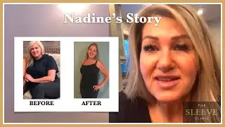 Nadine’s Journey To Losing 56 lbs With The Sleeve Clinic