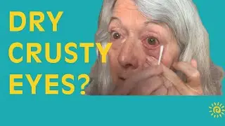 How to clean your dry crusty goopy eyes