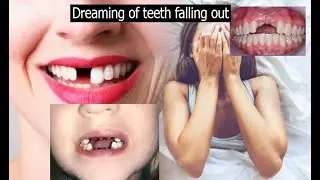 DREAMING OF YOUR TEETH FALLING OUT Biblical meaning || your teeth being removed