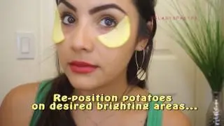 Reduce under eye circles with potatoes