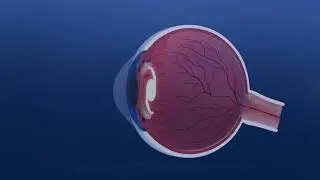 Specialty Eye Institute Now Offering the Vivity Extended Focus IOL