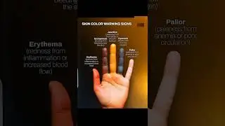 warning ⚠️ skin color #youtubeshorts #skin