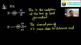 Dipole moment