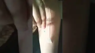 Peel porn/waxing angs leg with glue