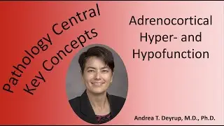 Medical School Pathology: Pathophysiology of Adrenocortical Hyper- and Hypofunction
