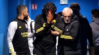 Lyon bus attack sees coach Grosso and assistant Longo suffer from serious face injuries