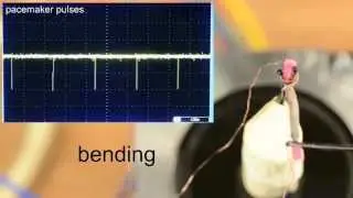 UTD Nanotech pacemaker lead demo
