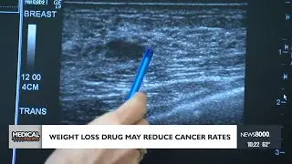 Weight loss drug may reduce cancer rates