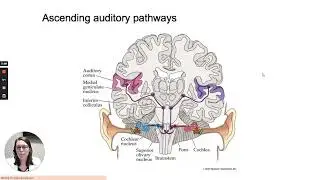 What is the Auditory System?