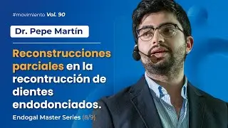 🎓 Reconstrucciones parciales en la reconstrucción de dientes endodonciados - Dr. Pepe Martín #Vol.90