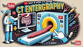 CT Enterography Preparation:Patient Guidelines & Radiology Tips for Beginners| Medical Professionals