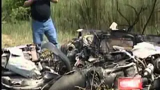 A burn victim volunteers time to help others through process