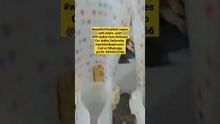 #Viral #AFO #Ankle #Deformity #ViralVideo #AnkleFootOrthosis #BestServices #BestProducts  #India