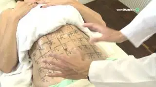 Operación biquini. El mejor tratamiento para acabar con la flacidez