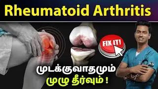 Rheumatoid Arthritis Symptoms | Causes | Treatment | Easy Solution | Robotic Knee Replacement